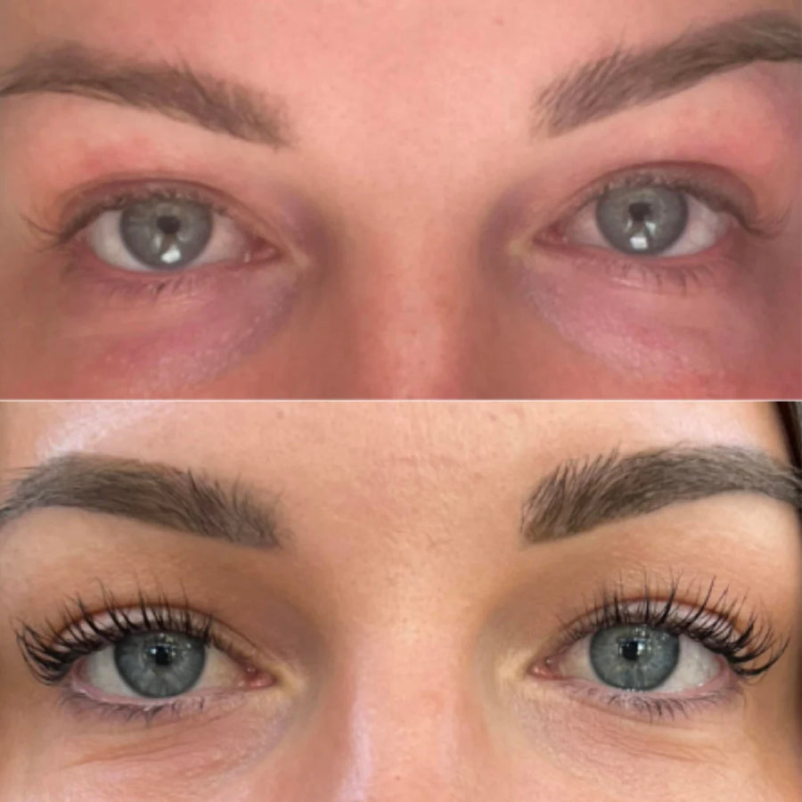 Bekijk hoe anderen Lash Ease geweldig vinden.